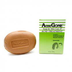 Acne Gone Soap Acne Treatment Soap 10.5oz Total
