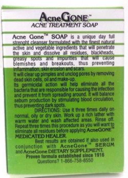 Acne Gone Soap