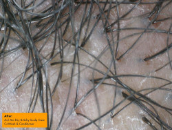 As I Am Dry & Itchy Scalp Care Cowash - 16 ounce - Enriched with Zinc Pyrithione, Olive Oil, and Tea Tree Oil - Fights Dandruff and Seborrheic Dermatitis