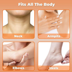 Carotis Brightening Gel | 30g / 1 fl oz | Fade Dark Spots on: Face Armpit, Body Knees, Feet, Hands, & Even Out Skin Tone | with Carrot Oil and Alpha Arbutin, For