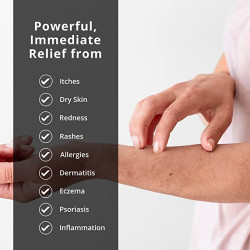 De La Cruz Hydrocortisone Cream - 1% Hydrocortisone Cream Maximum Strength Anti Itch Cream for Dry Skin, Redness, Dermatitis, Eczema and Rashes - Topical Ointment - 1 OZ (28g)