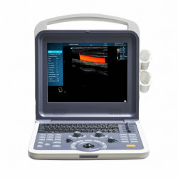 High Resolution Imaging System Smart Color Ultrasound Scanner Mslcu62 Portable Color Doppler Ultrasound Machine Price